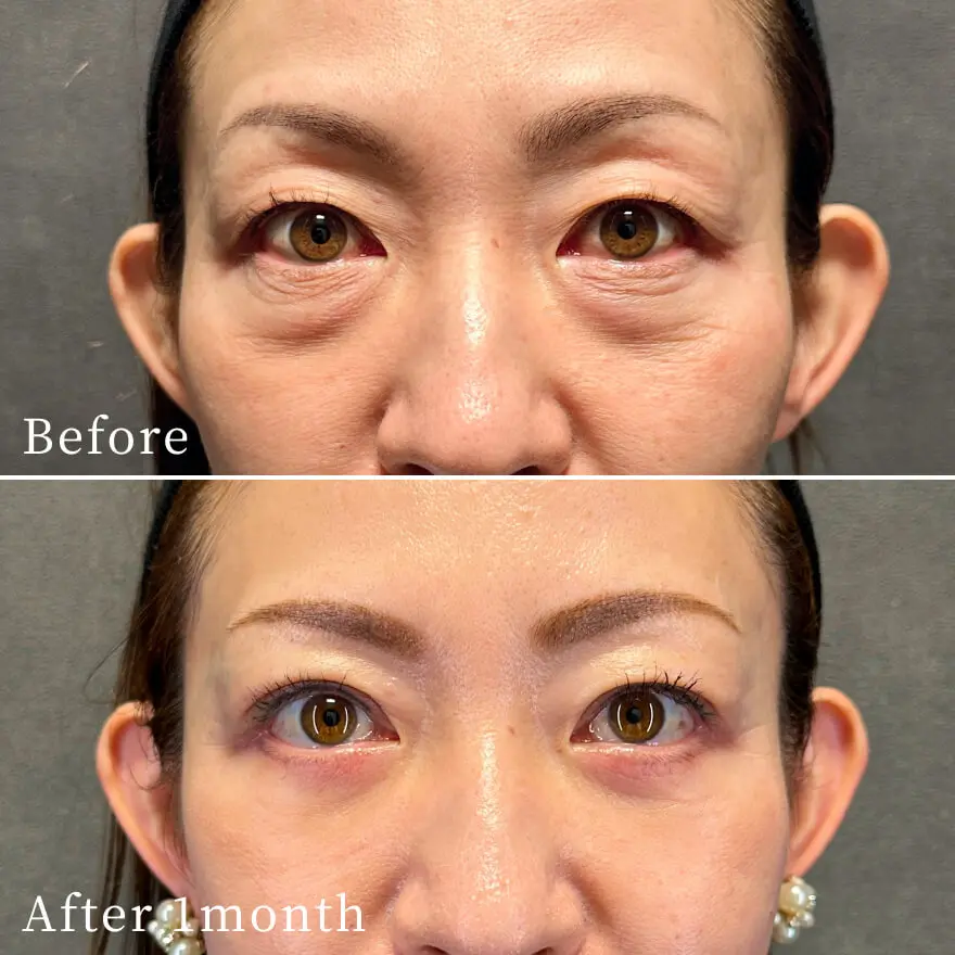 ビフォーアフター写真