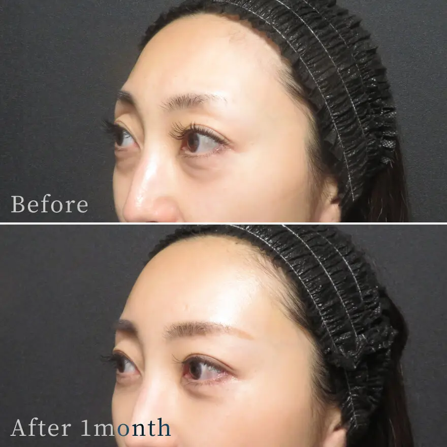 ビフォーアフター写真