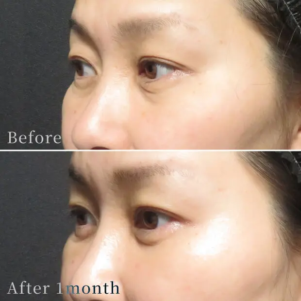 ビフォーアフター写真