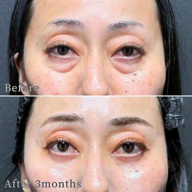 ビフォーアフター写真