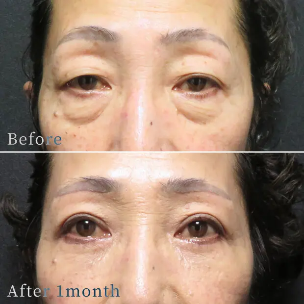 ビフォーアフター写真