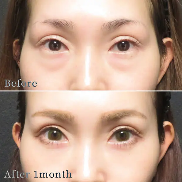 ビフォーアフター写真