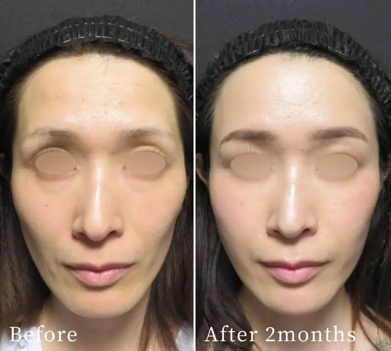 ビフォーアフター写真