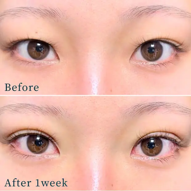 ビフォーアフター写真