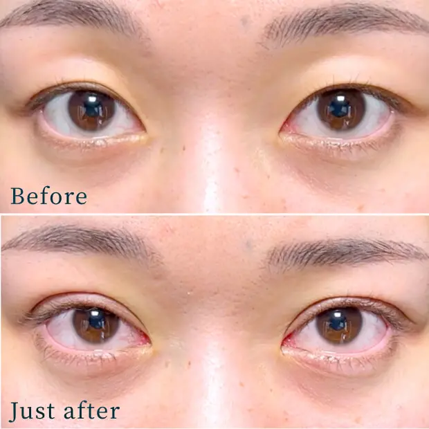 ビフォーアフター写真