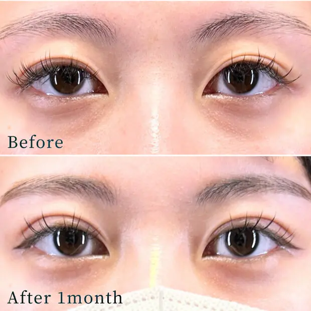 ビフォーアフター写真