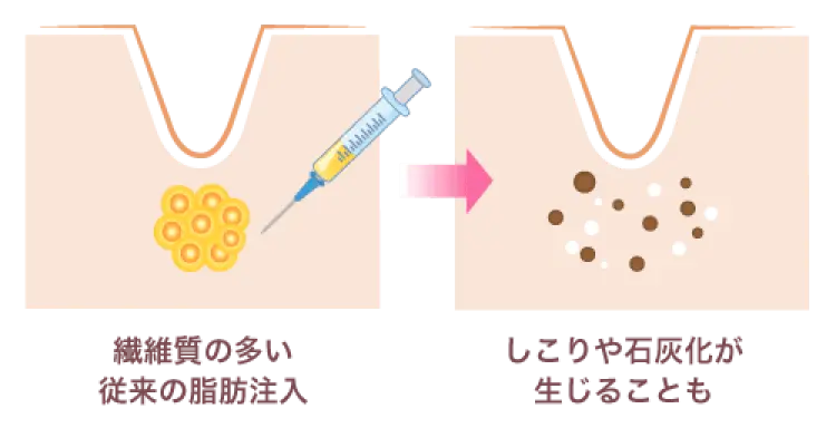 高い安全性を実現