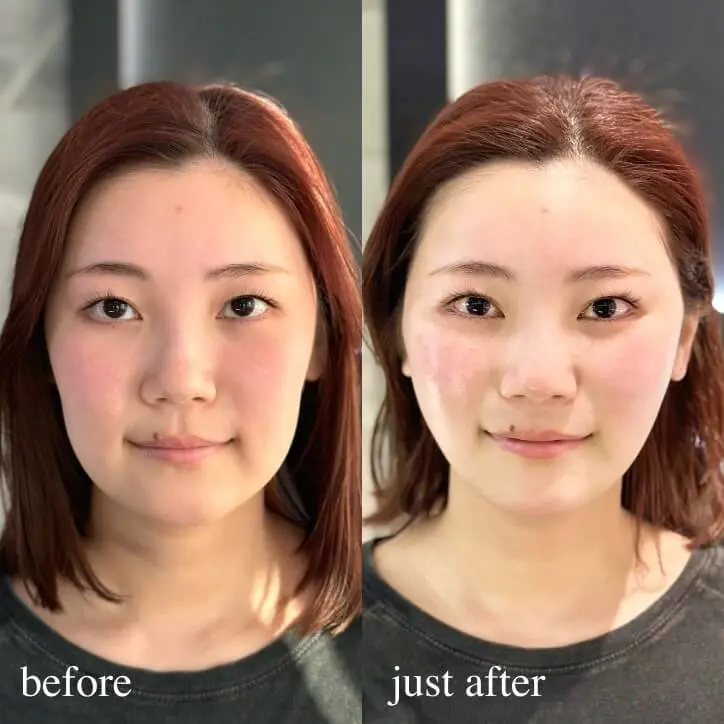 ビフォーアフター写真