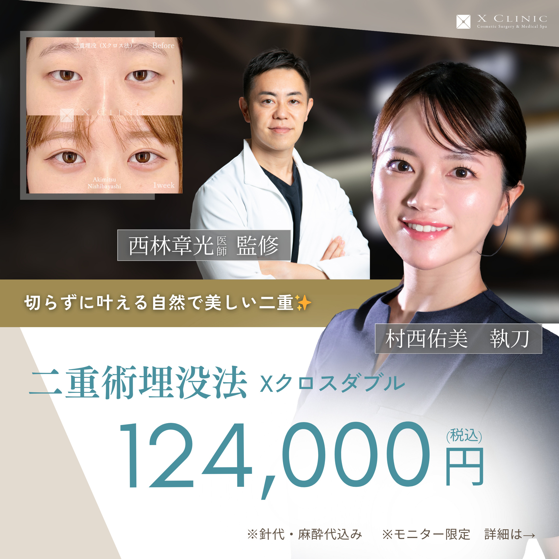 Campaign｜大阪院–エックスクリニック｜X CLINIC｜ エイジング