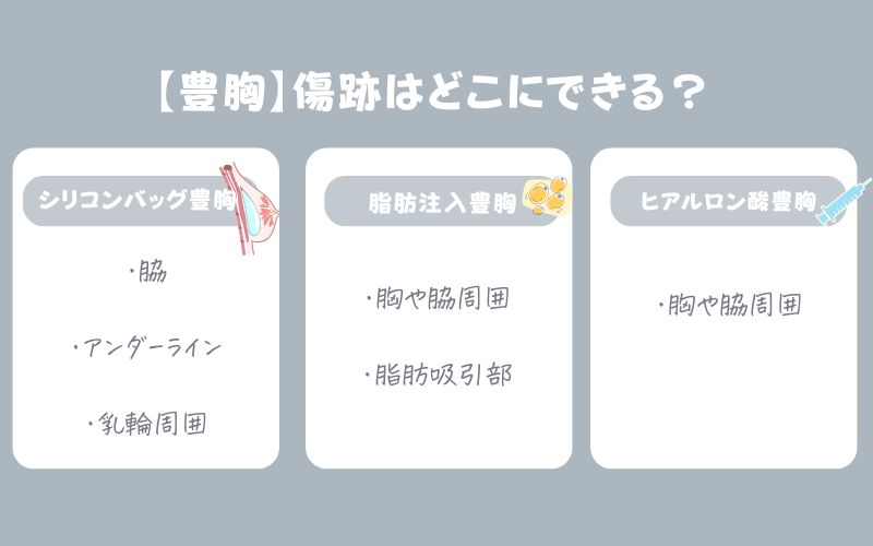豊胸後の傷跡はどこにできる?術式ごとに解説