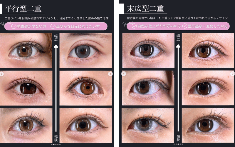 平行二重と末広二重はどう違う?写真でチェック
