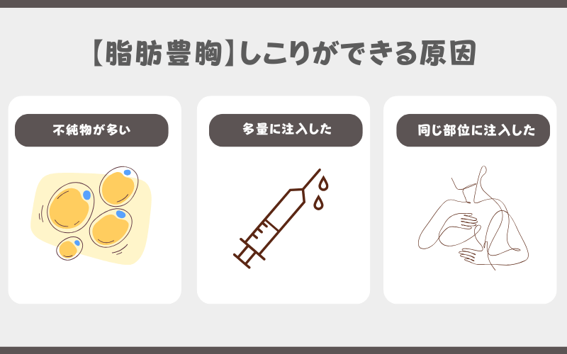 脂肪注入豊胸 しこり 原因