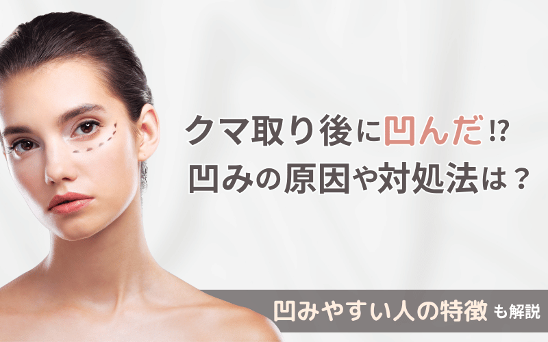クマ取り 凹み