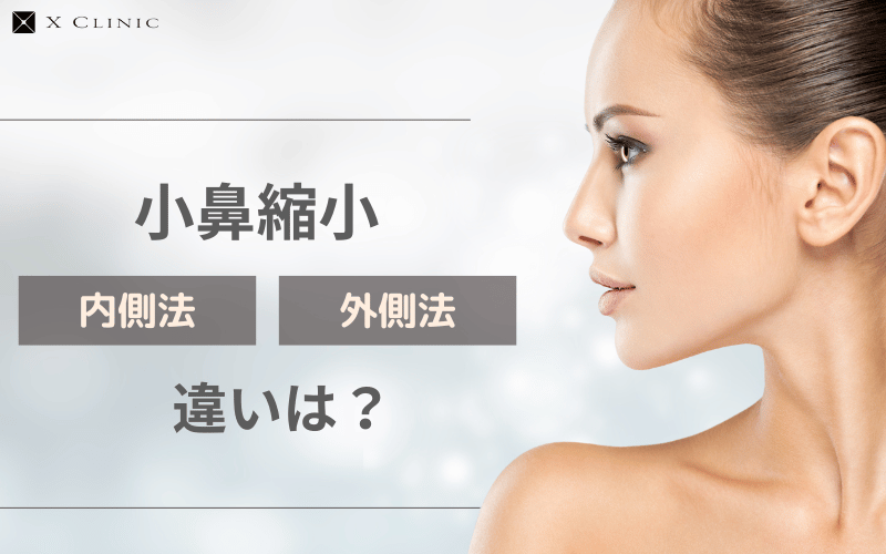 小鼻縮小　内側　外側　違い