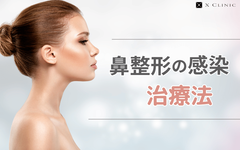 鼻整形 感染 治る