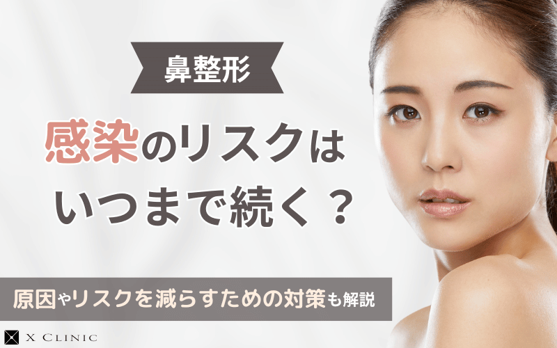 鼻整形 感染 リスク いつまで