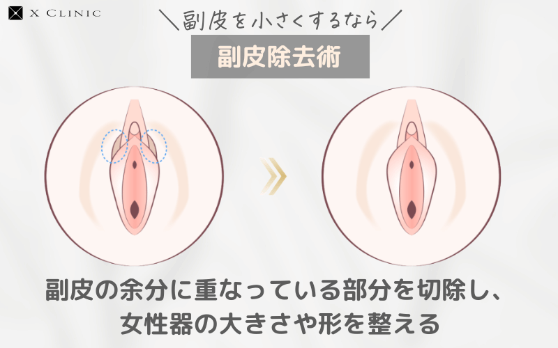 副皮 大きい