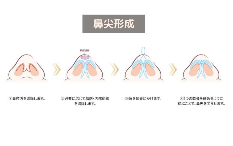 鼻尖形成
