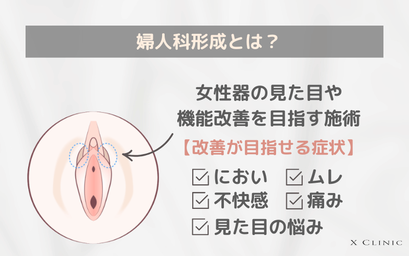 婦人科形成 名医