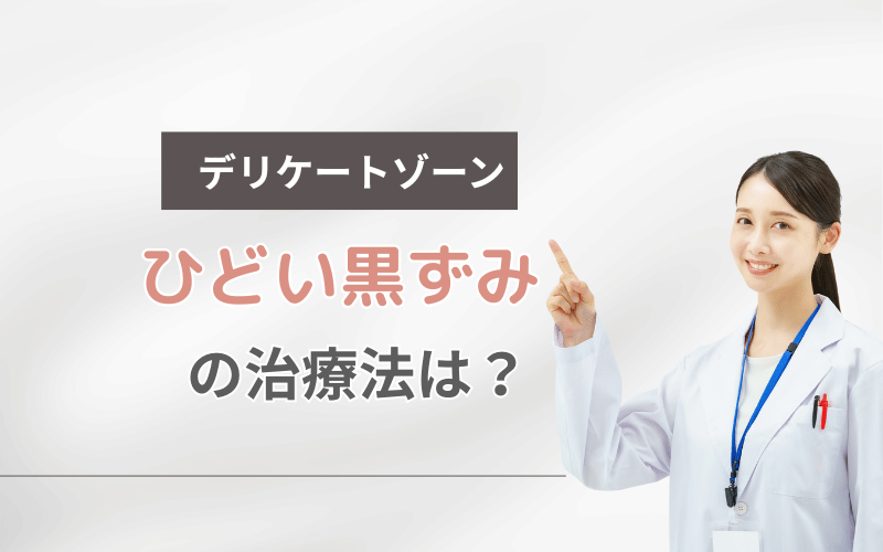 デリケートゾーン 黒ずみ ひどい