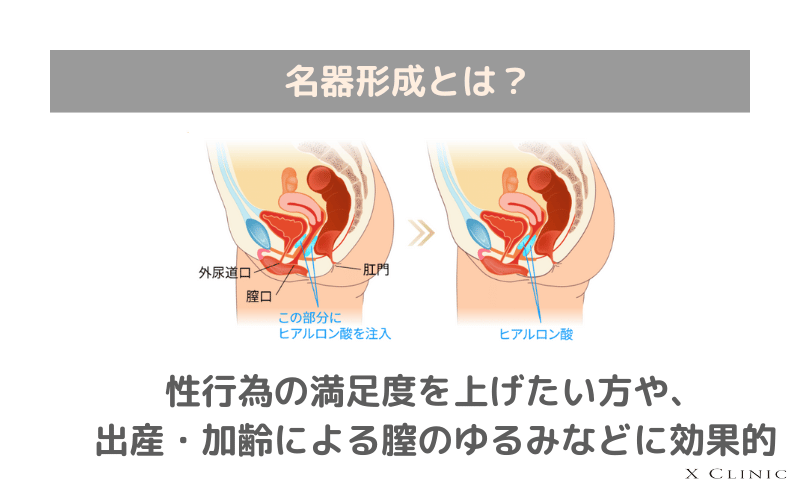 名器形成とは