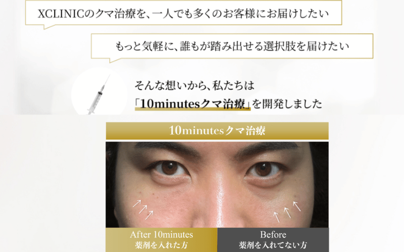 クマ取り ダウンタイムなし