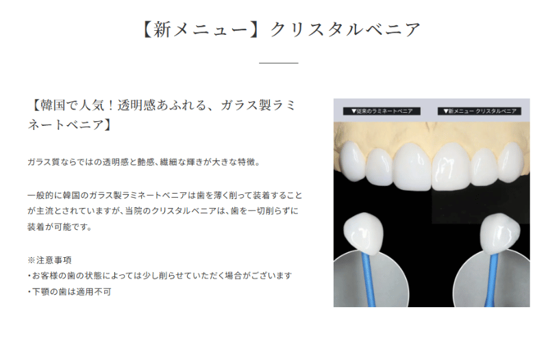 ラミネートべニア 後悔