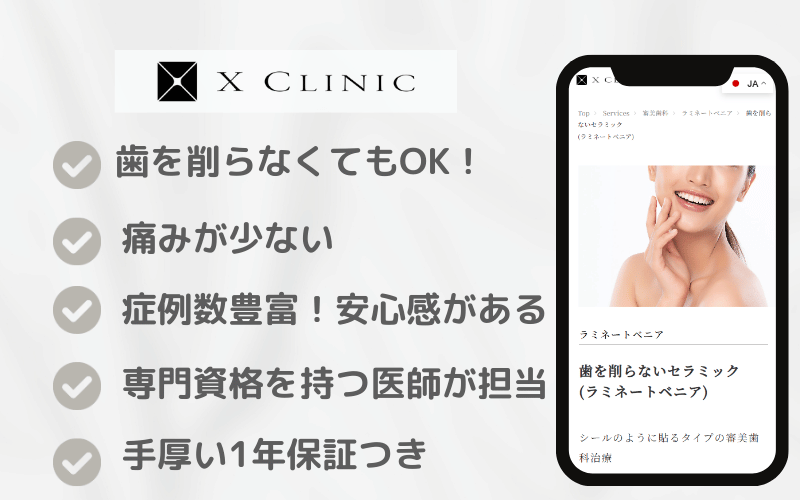 ラミネートべニア Xクリニック