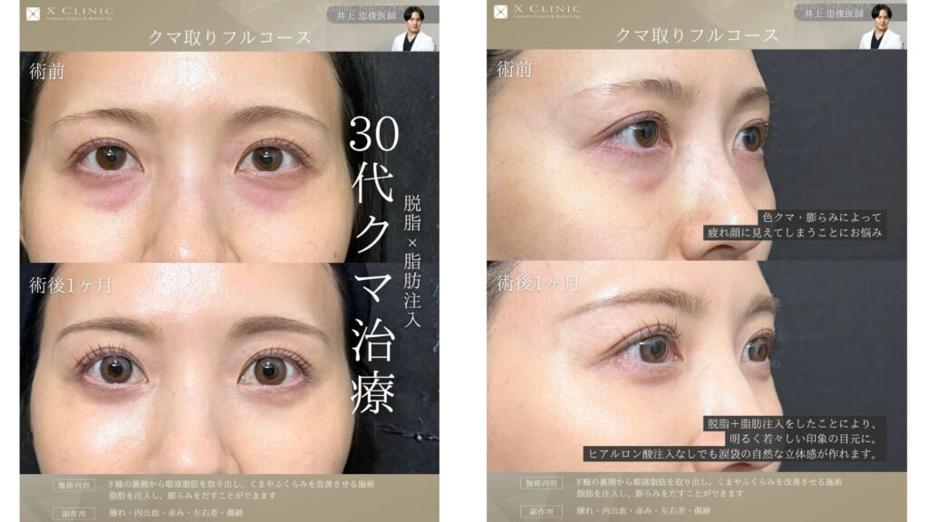 名古屋 クマ取り 名医