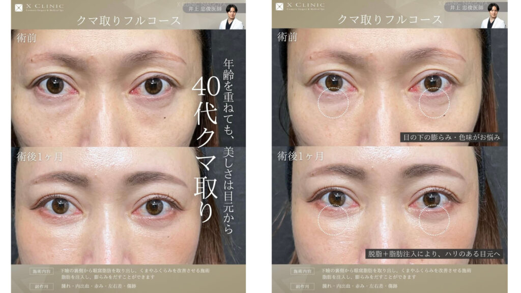 名古屋 クマ取り 名医