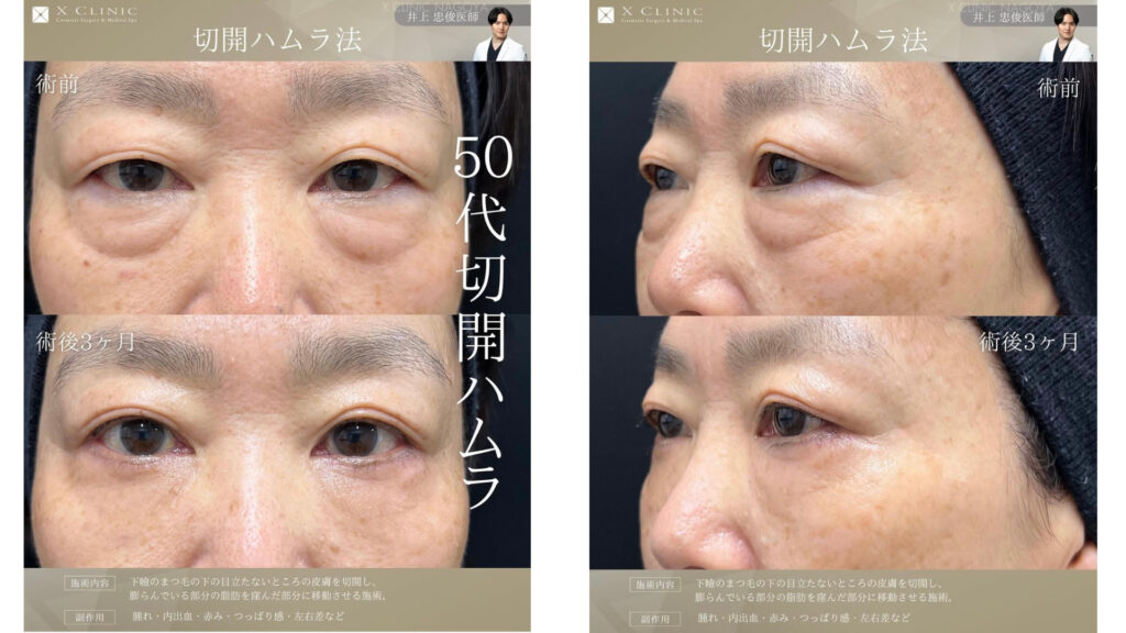 名古屋 クマ取り 名医