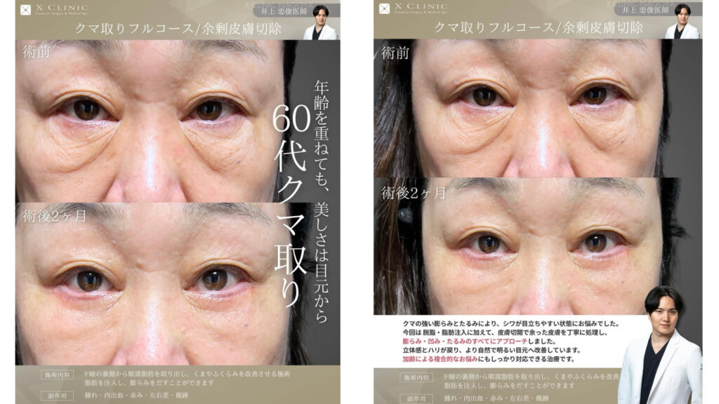 名古屋 クマ取り 名医