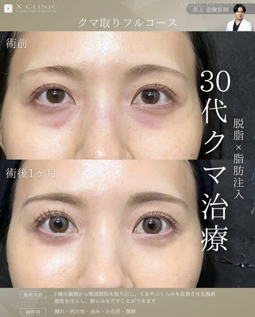 名古屋 クマ取り 名医