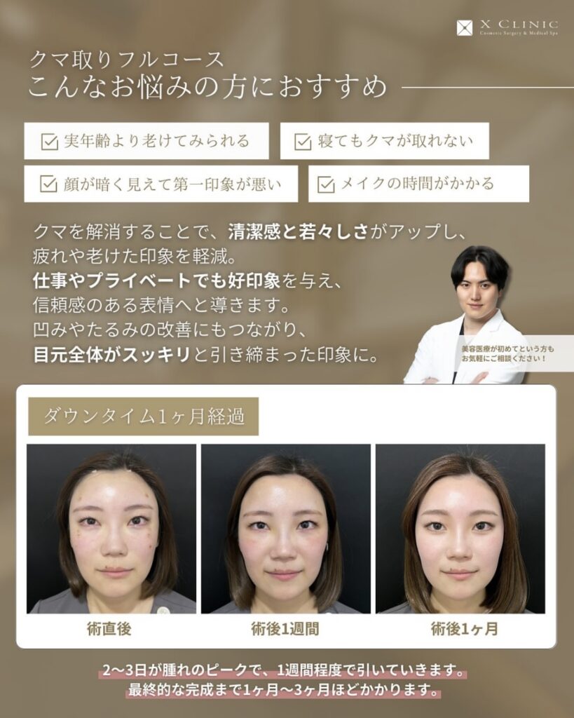 名古屋 クマ取り 名医