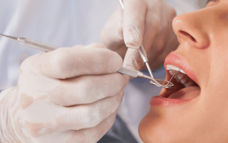 セラミック矯正 やばい