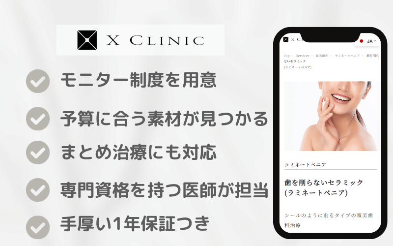 ラミネートべニア 値段