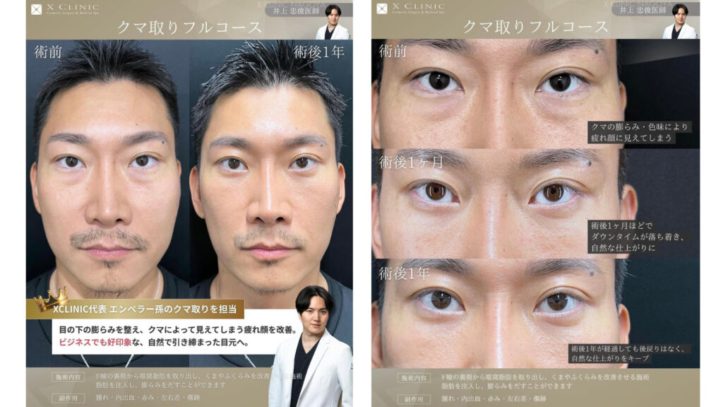 名古屋 クマ取り 名医