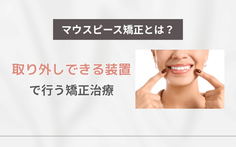 マウスピース矯正とは