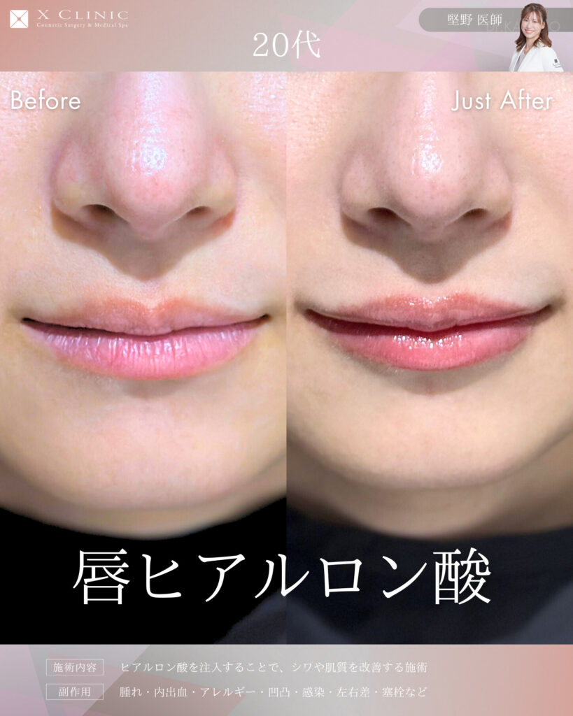 名古屋 ヒアルロン酸 名医