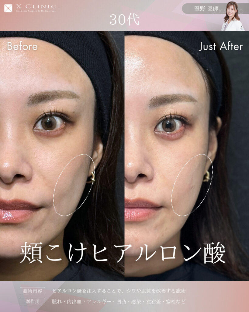 名古屋 ヒアルロン酸 名医