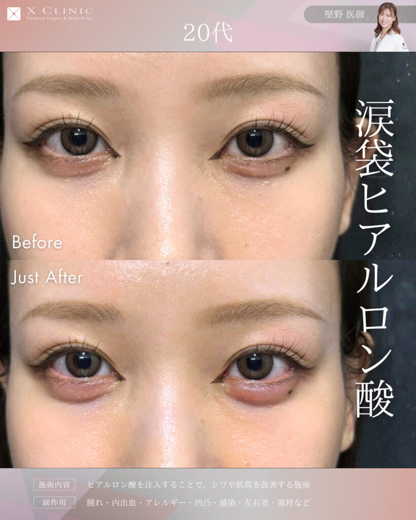 名古屋 ヒアルロン酸 名医