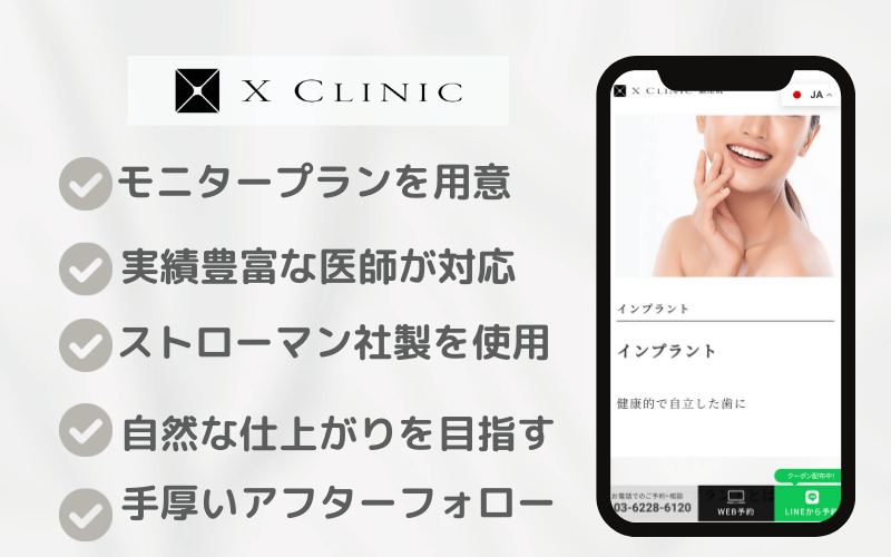 インプラント おすすめクリニック