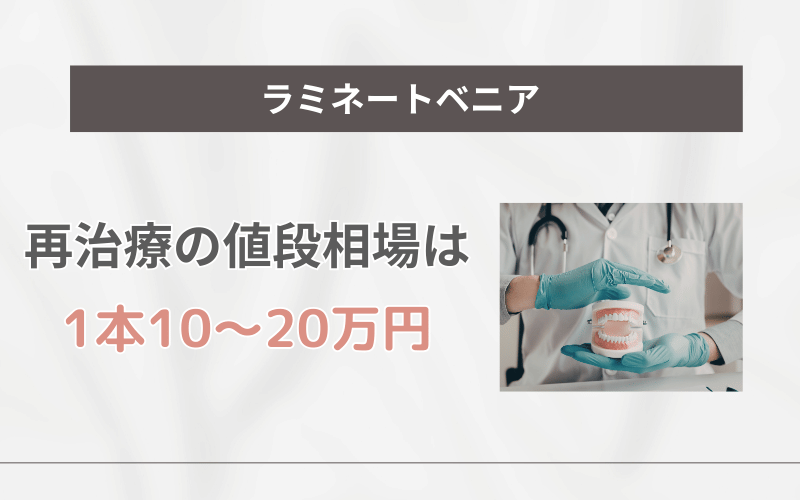 ラミネートべニア 寿命