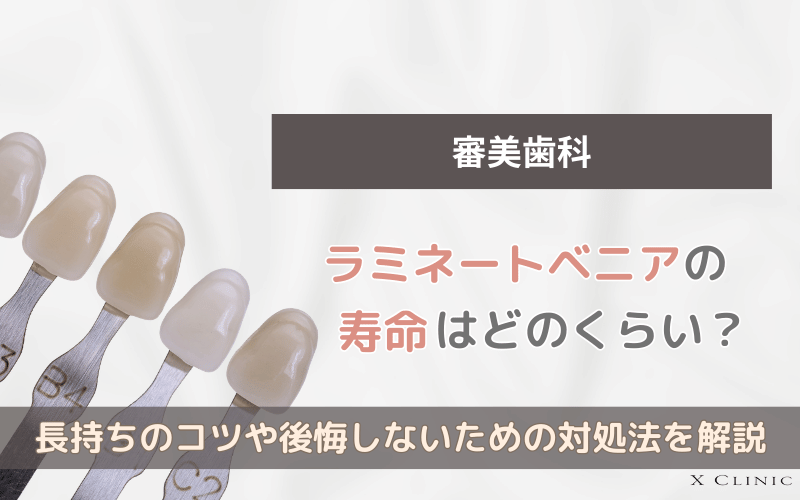 ラミネートべニア 寿命