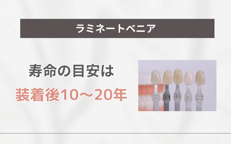 ラミネートべニア 寿命