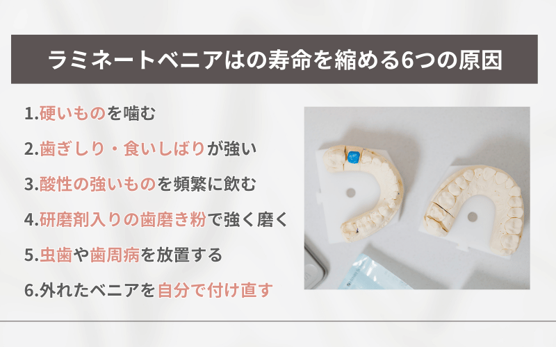 ラミネートべニア 寿命