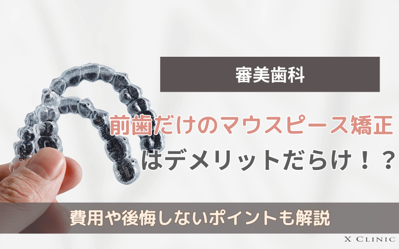 マウスピース矯正 前歯だけ